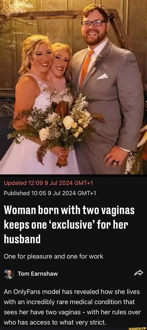 Woman born with two vaginas keeps one ‘exclusive’ for her husband